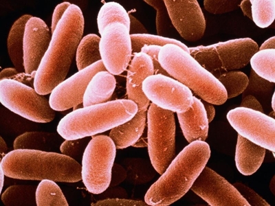 Listeriosis found on dairy farm and in two shops near Ladysmith