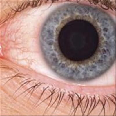 Dry eye syndrome