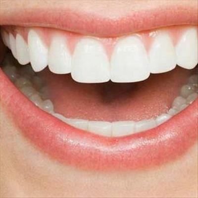 Dental trauma: The avulsed tooth 