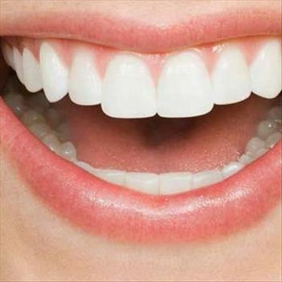 Dental trauma: The avulsed tooth 
