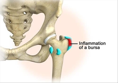 More about hip pain and its causes