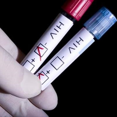 Pharmacies get go-ahead to sell Aids tests