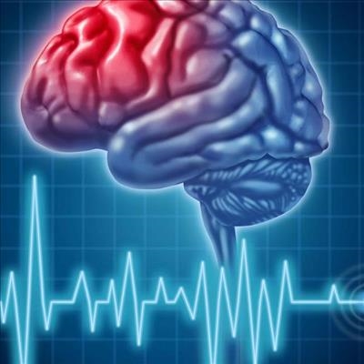 Would you recognise if someone is having a stroke?