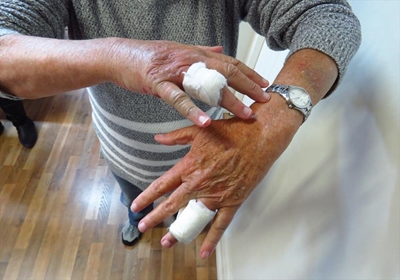 Attacker bites fingers to get rings