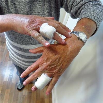 Attacker bites fingers to get rings
