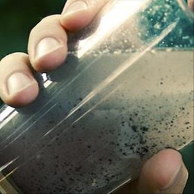 What is Typhoid fever?