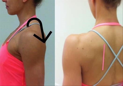 Achieving shoulder neutral position