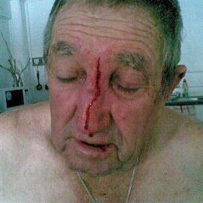 Update: Tourists attacked at Vic Bay