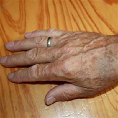 Tourist mugged on Sedgefield beach