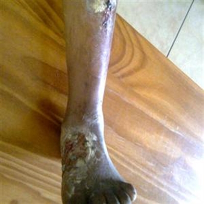 Seun se wonde met hondemis ‘behandel’