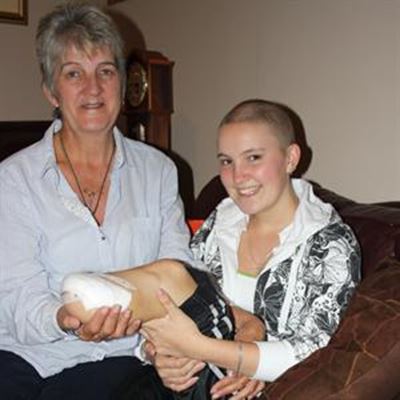 Local girl (18) loses leg to cancer