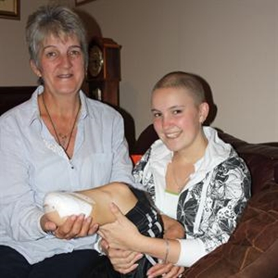 Local girl loses half her leg to cancer