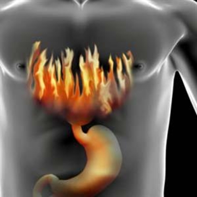 Prevent heartburn