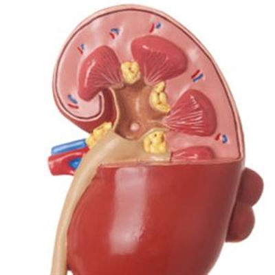 Living well with kidney disease 