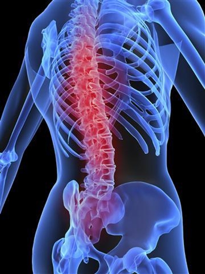 Warning signs of osteoporosis