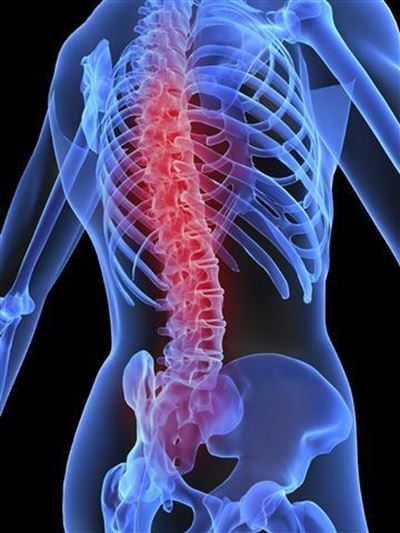 Warning signs of osteoporosis