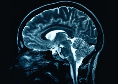 Brain scans help predict learning problems: Study