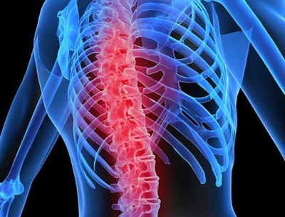 Ways to prevent Osteoporosis - the silent epidemic