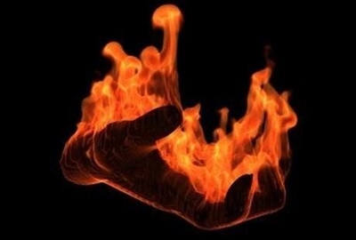 How to prevent burn injuries