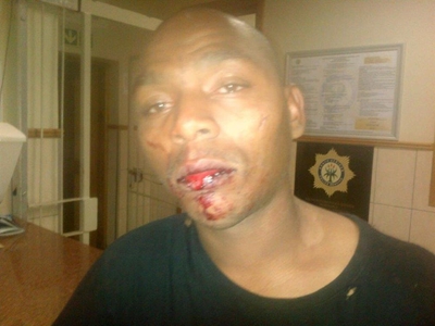 Speurder breek na bewering man se kakebeen