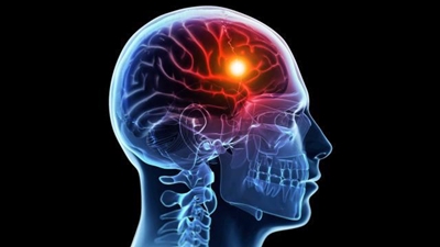 Facts about strokes