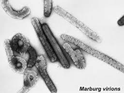 Uganda confirms Marburg Fever recently killed man