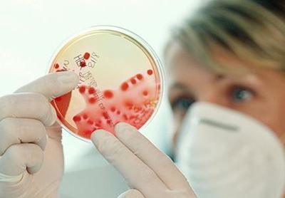 Uganda confirms Marburg Fever recently killed man