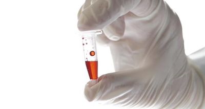 Canadian Ebola vaccine to begin testing