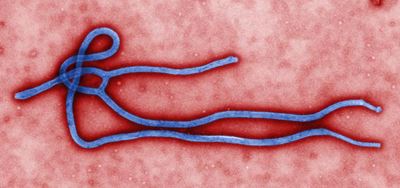 SA disease lab on front of Ebola fight