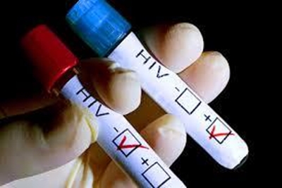 HIV 3rd leading cause of death: Stats SA