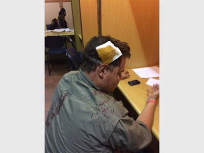 Samaritaan oor die kop geslaan
