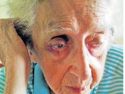Nurse caught for assaulting pensioner (84)