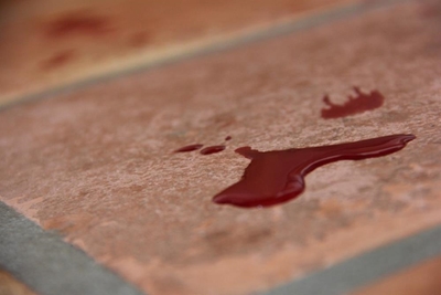 Shot man stumbles into police station