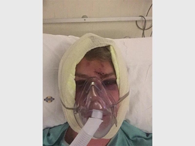 Man horrifically beaten at club