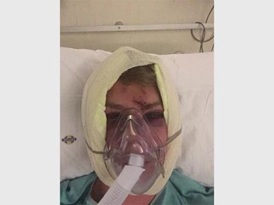 Man horrifically beaten at club