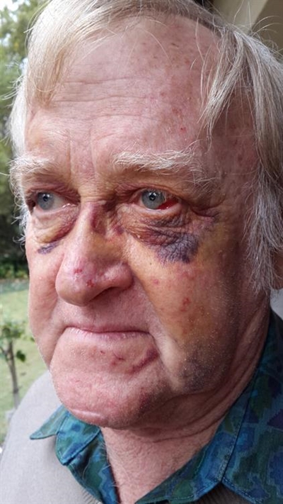 Elderly man’s jaw broken in road rage attack