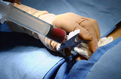 Bold initiative to increase the number of black bone marrow donors