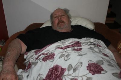 Update: 450 kg man to be hospitalised
