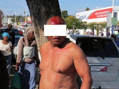 Man met gholfstok oor kop geslaan