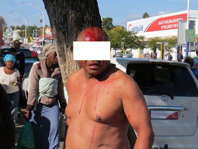 Man met gholfstok oor kop geslaan