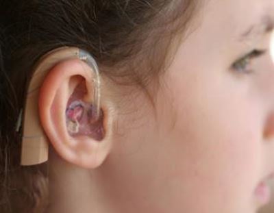 Deafness could be treated by virus, say scientists