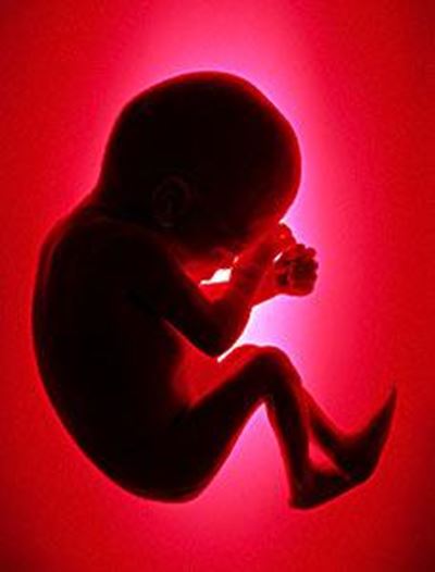 Aborted foetuses cause drain blockage
