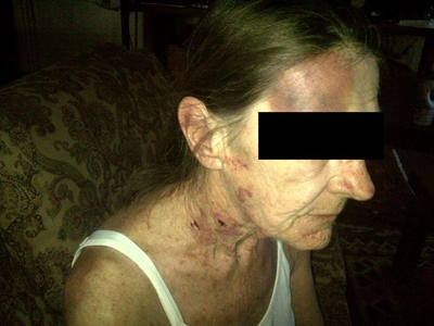 Elderly woman survives brutal torture