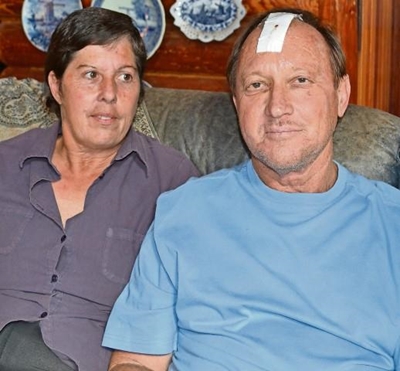 Man se skedel gebreek tydens plaasaanval