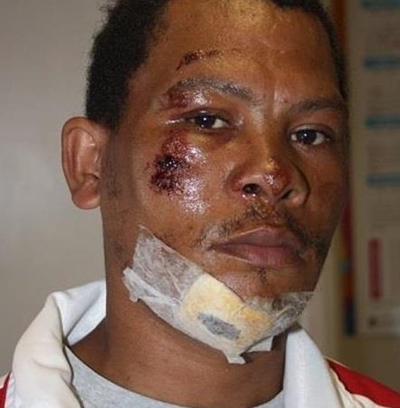 Cyclist hit by municipal refuse truck