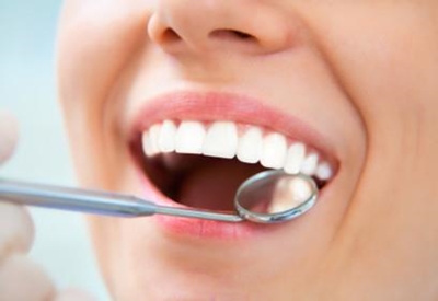 Managing mouth ulcers