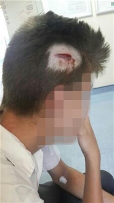 Kidney failure looming for assaulted boy