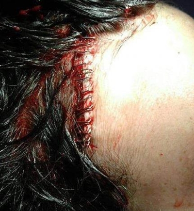 Teenager stabbed in head at Florida Lake