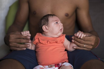 'Zika virus unlikely to reach SA'