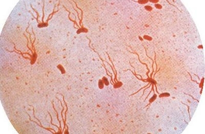 Typhoid fever spreads in Harare